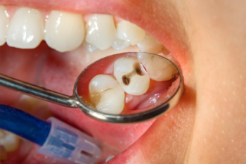 teeth problems in kids