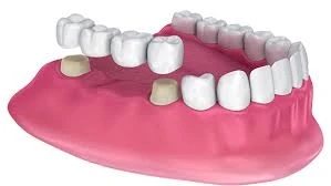 dental clinic in aundh